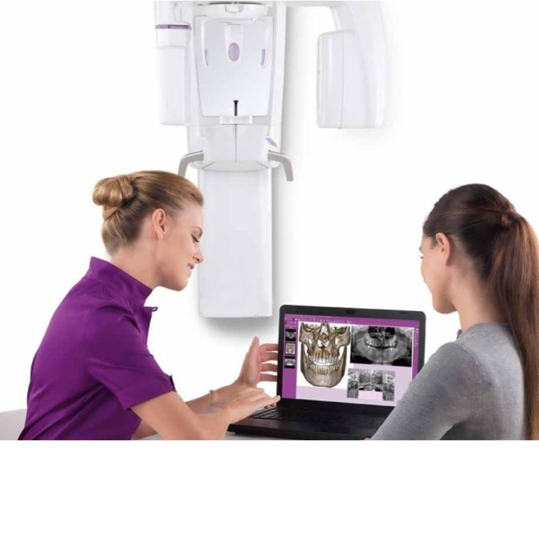 CBCT (3D RTG)